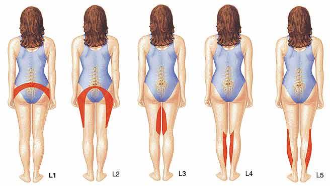 BSR & Hernia